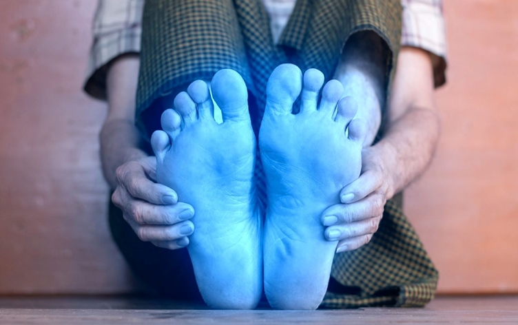 ئاماژەیەک بۆ ساردیی قاچەکان. 